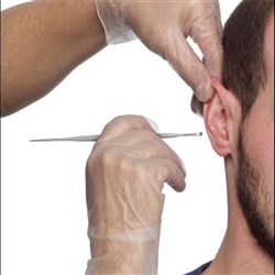 ProPulse ProScoop Single Use Ear Wax Removal Scoop PKT40