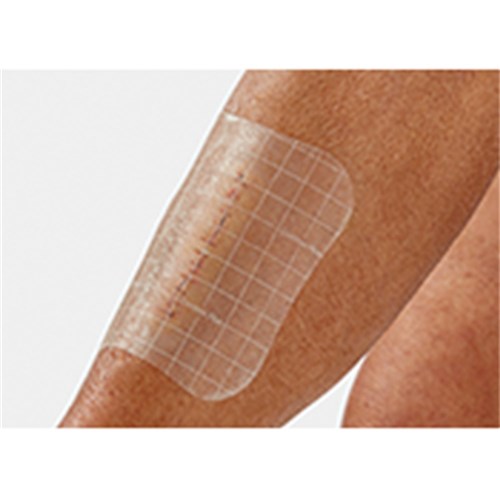 Comfeel Plus Transparent Dressing 5 x 25 B5