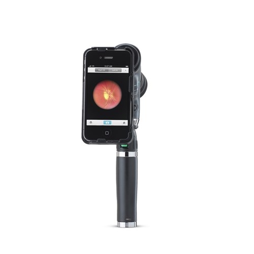 W.A iExaminer Brkt for Panoptic Ophthalmoscope/iPhone 4 & 4S