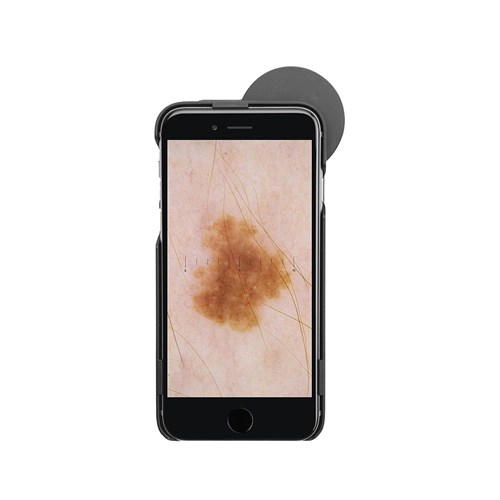 Heine iC1 Digital Dermatoscope for iPhone 6/6S
