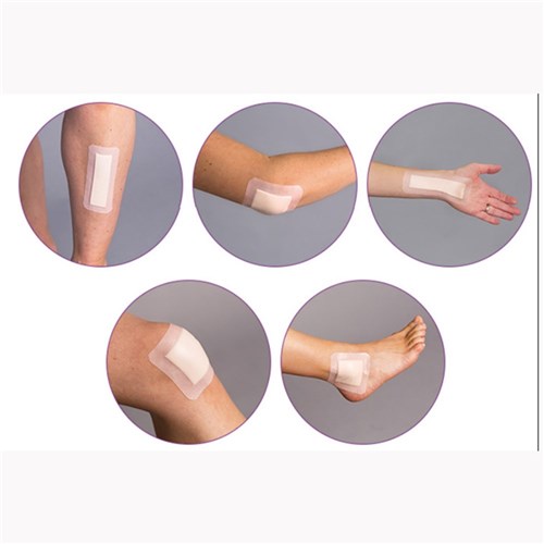 FoamLite Adhesive Dressing 10cm x 10cm