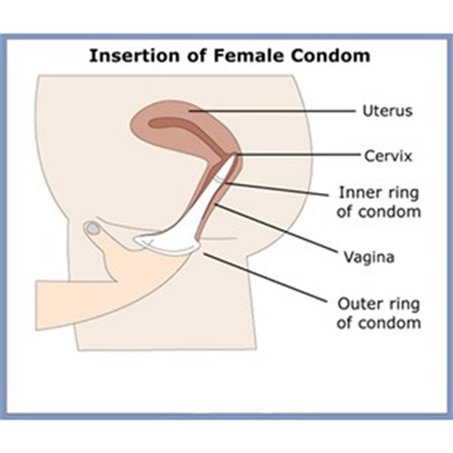 Female Condom Fc2 Single Unit Sealed Foil B100